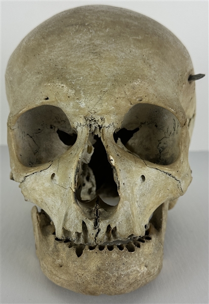 Incredible Actual Human Skull with Stone Arrowhead Lodged in Side! (Ex. Robert White Collection)